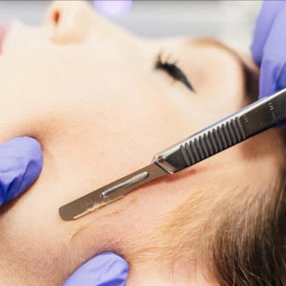 Pack of 6 Glass Skin Dermaplaning at Martina Skin Atelier in Hartsdale, NY